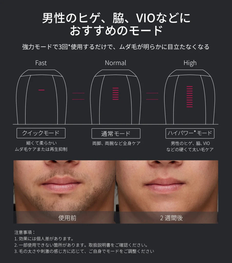 Ulike Men IPL光美容器